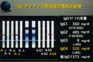 �hg�f�T�u�N���X�Ɖu�Œ�d�C�j����