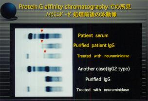 Protein G Affinity chromatography�ł̏����A�m�C���~�j�_�[�[�����O��̉j����