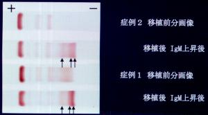 �`������p�^�[��