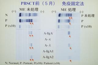 PBSCT��O(5��)�Ɖu�Œ�@