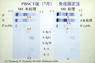 PBSCT��(7��)�Ɖu�Œ�@