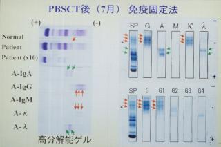 PBSCT��(7��)�Ɖu�Œ�@