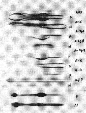 �Ɖu�d�C�j����