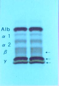 �U�C���O����