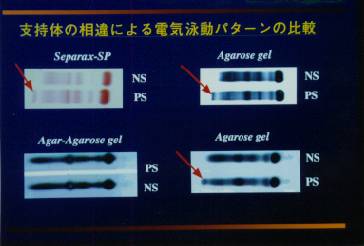 �x���̂ɂ��Ⴂ�i�`������j