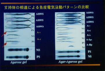 �x���̂ɂ��Ⴂ�i�Ɖu�j