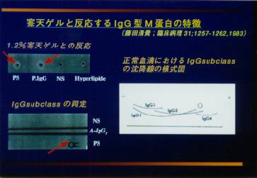 �T�u�N���X