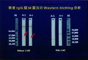 WESTERN BLOTTING
