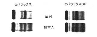 �Z�A���̔�r