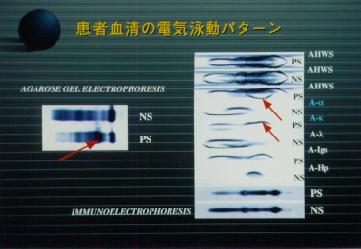 �A�K���[�X�ɂ�镪��