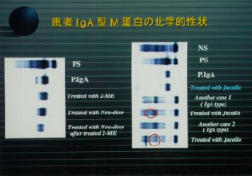 IgG-M���w�I����