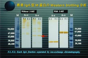 WESTERN BLOTTING