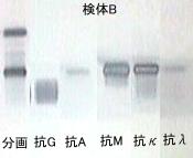 IgM�^M�`����IgM