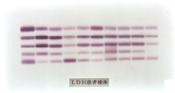 LDH���Ҍ���